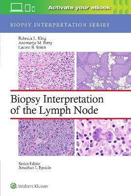 Biopsy Interpretation of the Lymph Node book