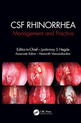 CSF Rhinorrhoea: Management and Practice by Jyotirmay S. Hegde