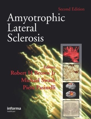 Amyotrophic Lateral Sclerosis by Robert H. Brown