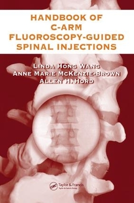 The The Handbook of C-Arm Fluoroscopy-Guided Spinal Injections by Linda Hong Wang