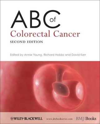 ABC of Colorectal Cancer book