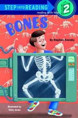 Bones by Dr Stephen Krensky