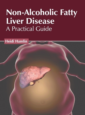 Non-Alcoholic Fatty Liver Disease: A Practical Guide book