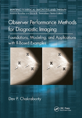 Observer Performance Methods for Diagnostic Imaging: Foundations, Modeling, and Applications with R-Based Examples by Dev P. Chakraborty