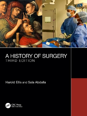 A History of Surgery: Third Edition by Harold Ellis