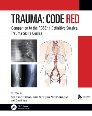 Trauma: Code Red: Companion to the RCSEng Definitive Surgical Trauma Skills Course book