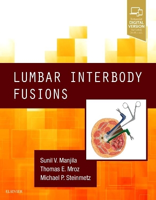 Lumbar Interbody Fusions book