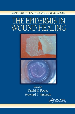 The Epidermis in Wound Healing by David T. Rovee