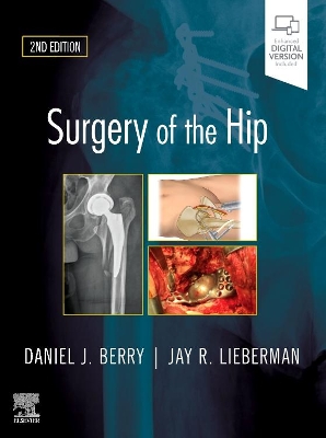 Surgery of the Hip by Daniel J. Berry