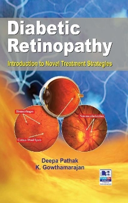 Diabetic Retinopathy: Introduction to Novel Treatment Strategies book