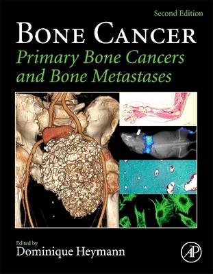 Bone Cancer book