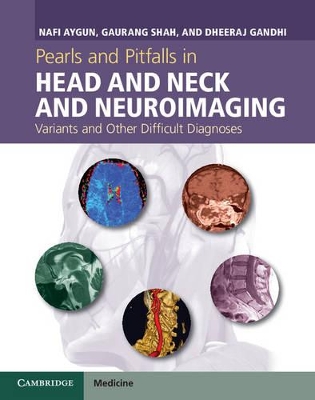 Pearls and Pitfalls in Head and Neck and Neuroimaging book