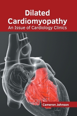 Dilated Cardiomyopathy: An Issue of Cardiology Clinics book