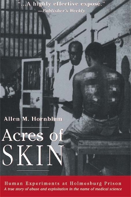 Acres of Skin: Human Experiments at Holmesburg Prison by Allen M. Hornblum