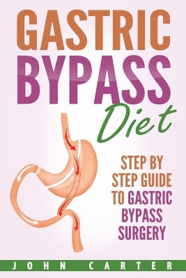 Gastric Bypass Diet: Step By Step Guide to Gastric Bypass Surgery by John Carter