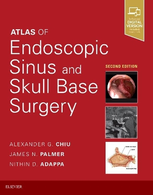 Atlas of Endoscopic Sinus and Skull Base Surgery book