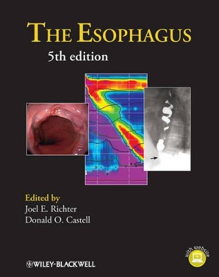 Esophagus book