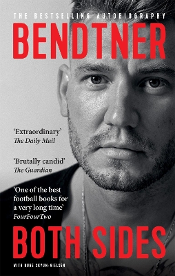 Bendtner: Both Sides: The Bestselling Autobiography by Nicklas Bendtner