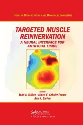 Targeted Muscle Reinnervation book