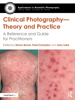 Clinical Photography — Theory and Practice: A Reference and Guide for Practitioners by Simon Brown