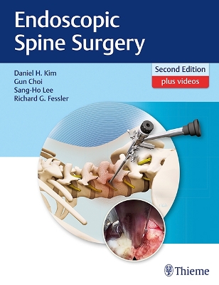 Endoscopic Spine Surgery book