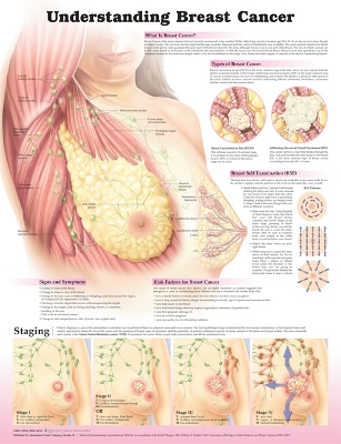 Understanding Breast Cancer 3E Laminated book