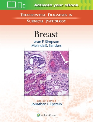 Differential Diagnoses in Surgical Pathology: Breast book