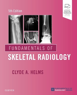 Fundamentals of Skeletal Radiology book