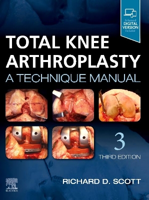 Total Knee Arthroplasty: A Technique Manual book