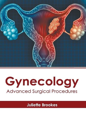 Gynecology: Advanced Surgical Procedures book