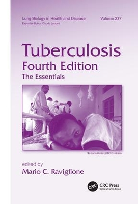 Tuberculosis book