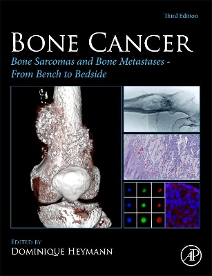 Bone Cancer: Bone Sarcomas and Bone Metastases From Bench to Bedside by Dominique Heymann