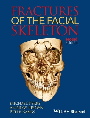 Fractures of the Facial Skeleton book
