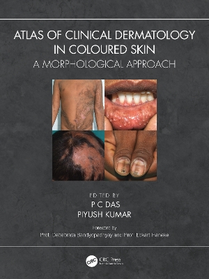 Atlas of Clinical Dermatology in Coloured Skin: A Morphological Approach book