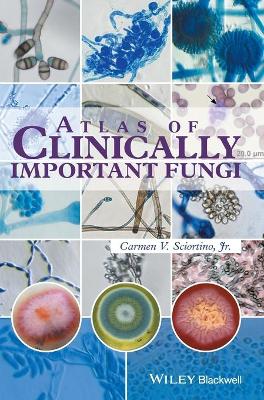 Atlas of Clinically Important Fungi book