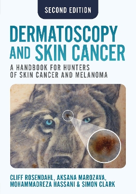 Dermatoscopy and Skin Cancer, second edition: A handbook for hunters of skin cancer and melanoma book
