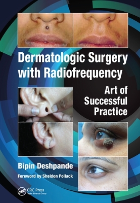 Dermatologic Surgery with Radiofrequency: Art of Successful Practice by Bipin Deshpande