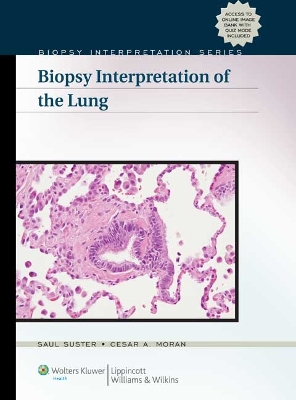 Biopsy Interpretation of the Lung by Saul Suster