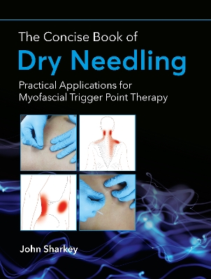 The Concise Book of Dry Needling: Practical Applications for Myofascial Trigger Point Therapy book