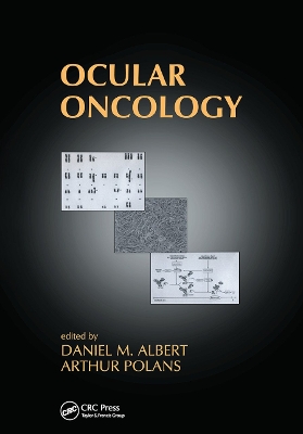 Ocular Oncology by Daniel M. Albert