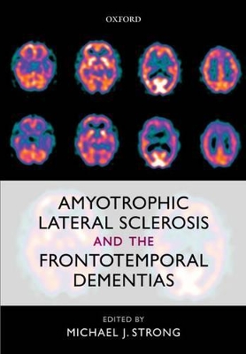 Amyotrophic Lateral Sclerosis and the Frontotemporal Dementias by Michael J Strong