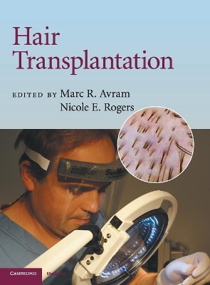 Hair Transplantation book