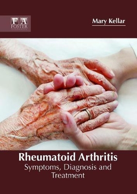 Rheumatoid Arthritis: Symptoms, Diagnosis and Treatment book