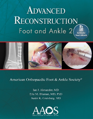 Advanced Reconstruction: Foot and Ankle 2: Print + Ebook book