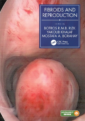 Fibroids and Reproduction by Botros R.M.B. Rizk