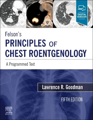 Felson's Principles of Chest Roentgenology, A Programmed Text: A Programmed Text book