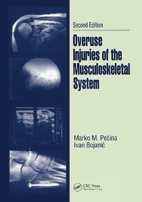 Overuse Injuries of the Musculoskeletal System book