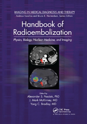 Handbook of Radioembolization: Physics, Biology, Nuclear Medicine, and Imaging by Alexander S. Pasciak, PhD.