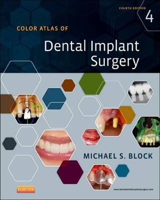 Color Atlas of Dental Implant Surgery book