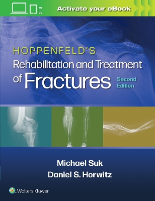 Hoppenfeld's Rehabilitation and Treatment of Fractures book